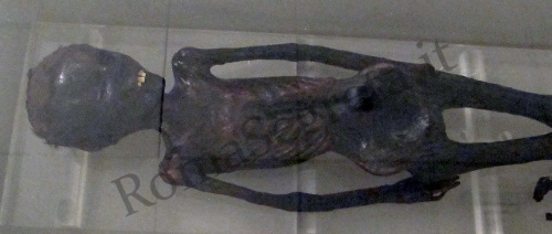mummia di grottarossa a palazzo massimo alle terme