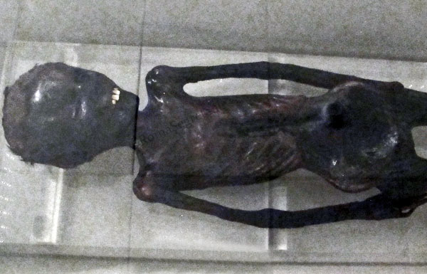 mummia di grottarossa a palazzo massimo alle terme